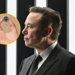 Elon Musk anuncia el primer implante de un chip en el cerebro de un humano