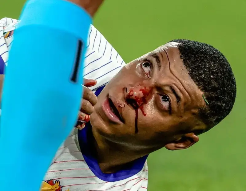 Kylian Mbappé
