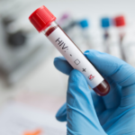 Logran la primera curación de VIH con trasplante de células madre