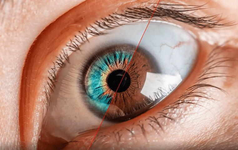 Famosos se someten a la queratopigmentación, una arriesgada cirugía para cambiar el color de ojos