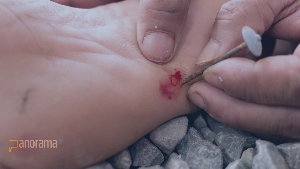 Tétanos bajo vigilancia en RD: Salud Pública reporta 28 casos sospechosos