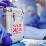 Realizan el primer trasplante de un corazón latente en el mundo