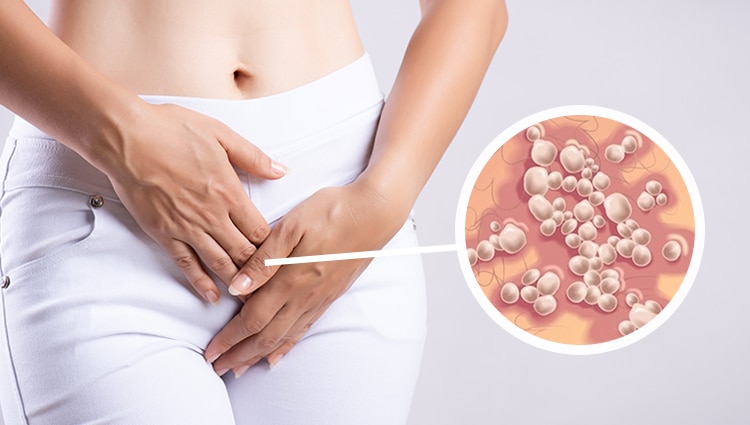 Estudio revela que de cada cinco personas entre 15 y 49 años padece herpes genital