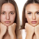 Mayoría de fotos que presentan “el antes y después” de una cirugía estética en redes sociales son falsas