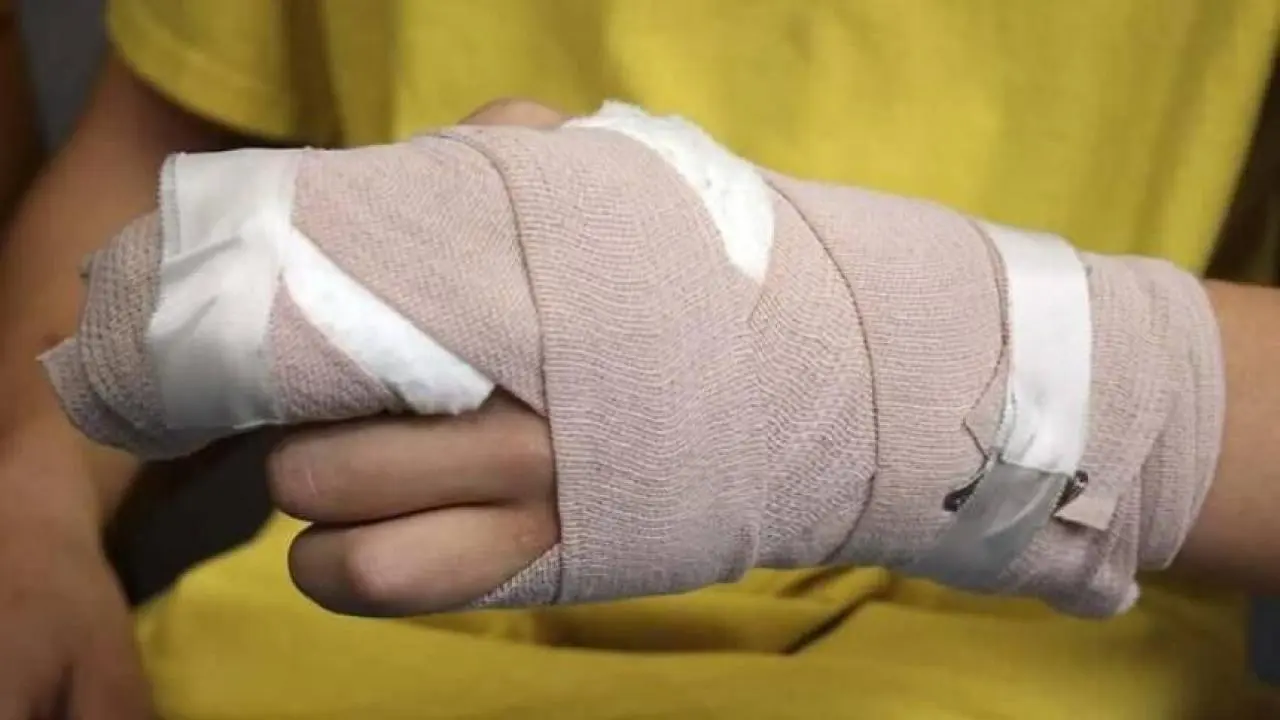 Familiares de niña quemada quieren justicia, denuncian amenazas de la agresora antes de cometer el hecho