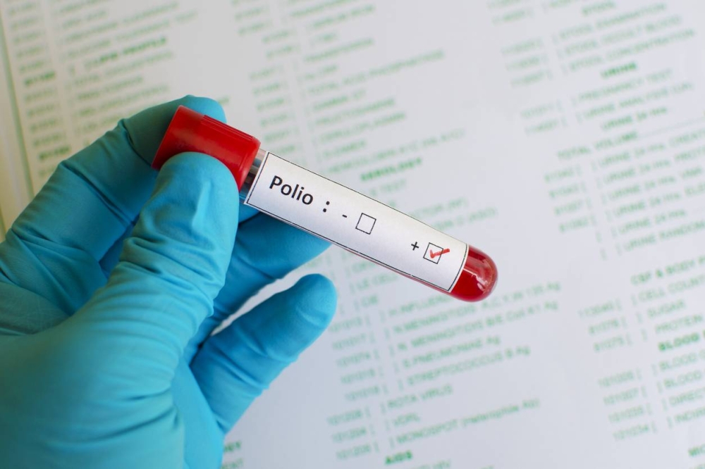 Emergencia nacional en Papúa Nueva Guinea por un brote de polio