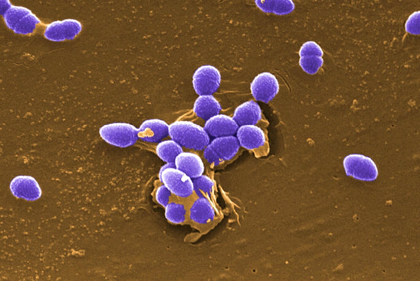 Encuentran peligrosos hongos vivos flotando en la estratósfera