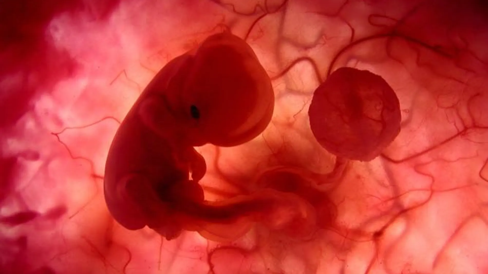 Que tan provechoso es comerse la placenta
