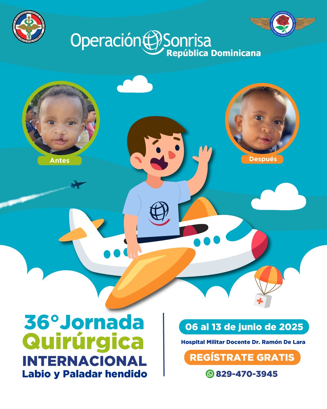 Panorama Salud. La Fundación Operación Sonrisa República Dominicana, en colaboración con el Hospital Militar Docente Dr. Ramón De Lara, anuncia con entusiasmo la realización de la 36.ª Jornada Quirúrgica Internacional de Labio y Paladar Hendido, que se llevará a cabo del 09 al 13 de junio de 2025.