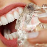 Los 3 hábitos que están arruinando tus dientes, según odontólogos, y que seguramente prácticas