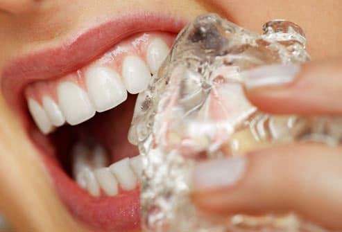 Los 3 hábitos que están arruinando tus dientes, según odontólogos, y que seguramente prácticas