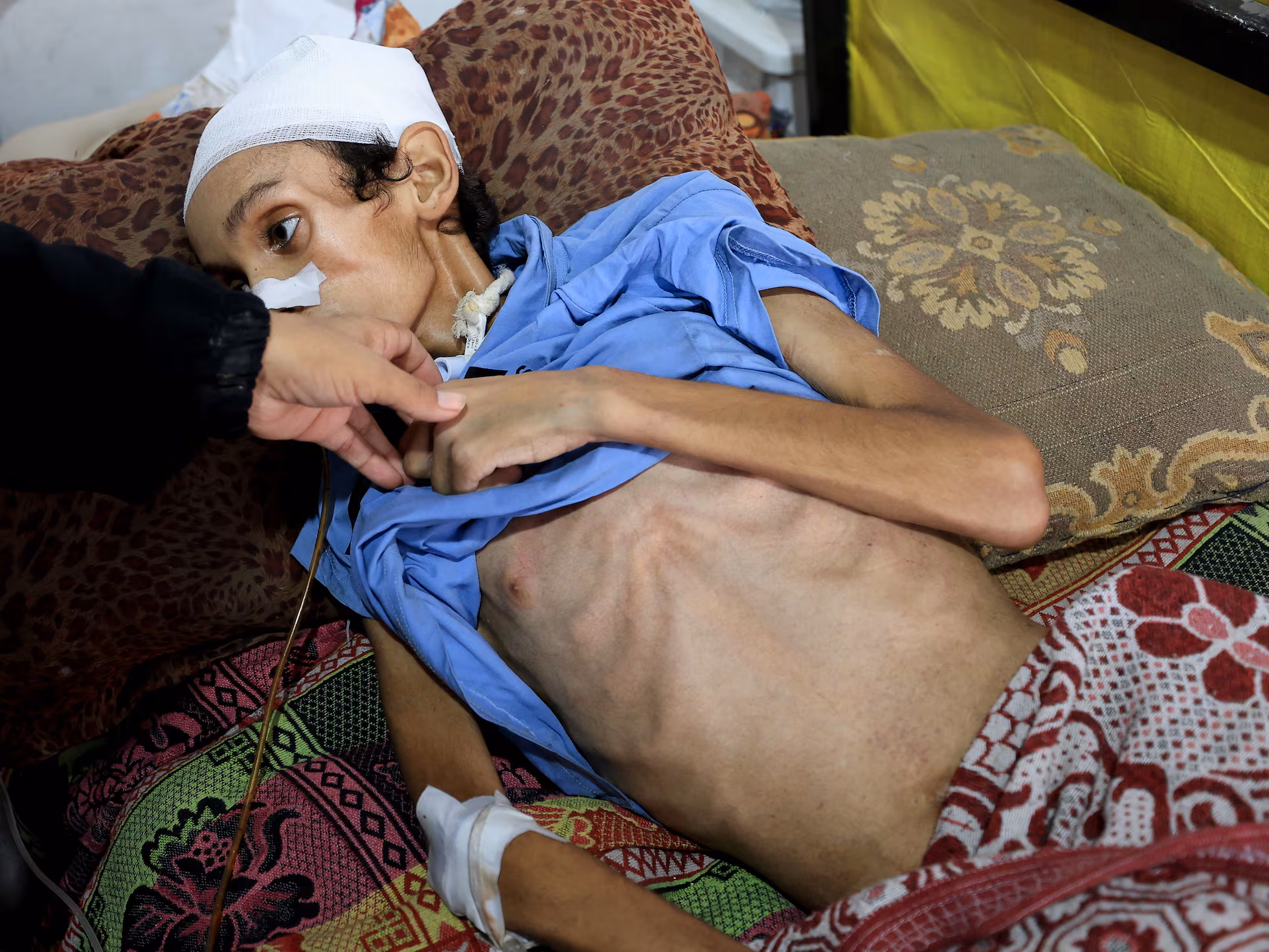 El hambre causa otros 10 muertos en Gaza en las últimas 24 horas
