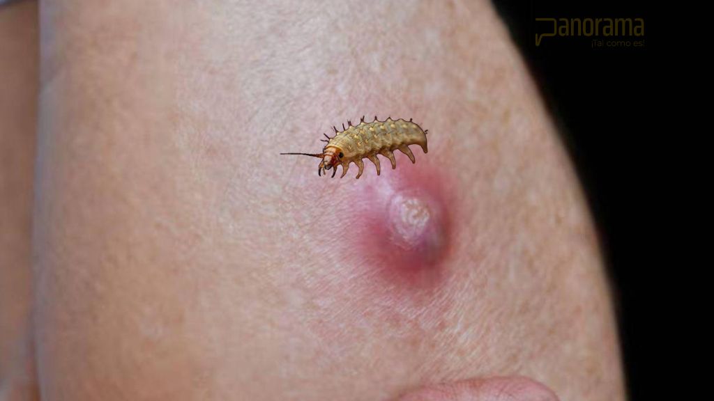 Emiten alerta sanitaria por la presencia del gusano barrenador en Nicaragua