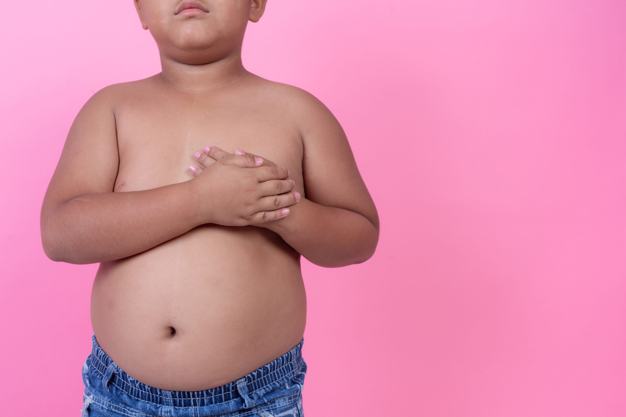 La obesidad infantil supera por primera vez al bajo peso como principal forma de malnutrición, alerta UNICEF