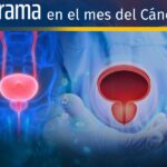 La IA y cáncer de vejiga.