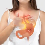 Un diagnóstico no claro del reflujo ácido puede influir en el desarrollo de enfermedades graves