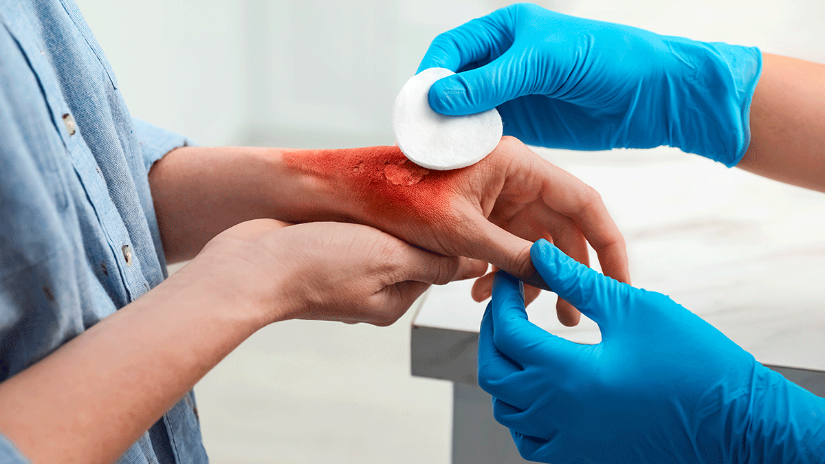 Demandan área de atención médica para quemados en Santiago