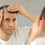 Cómo aliviar el estrés y prevenir la caída del cabello