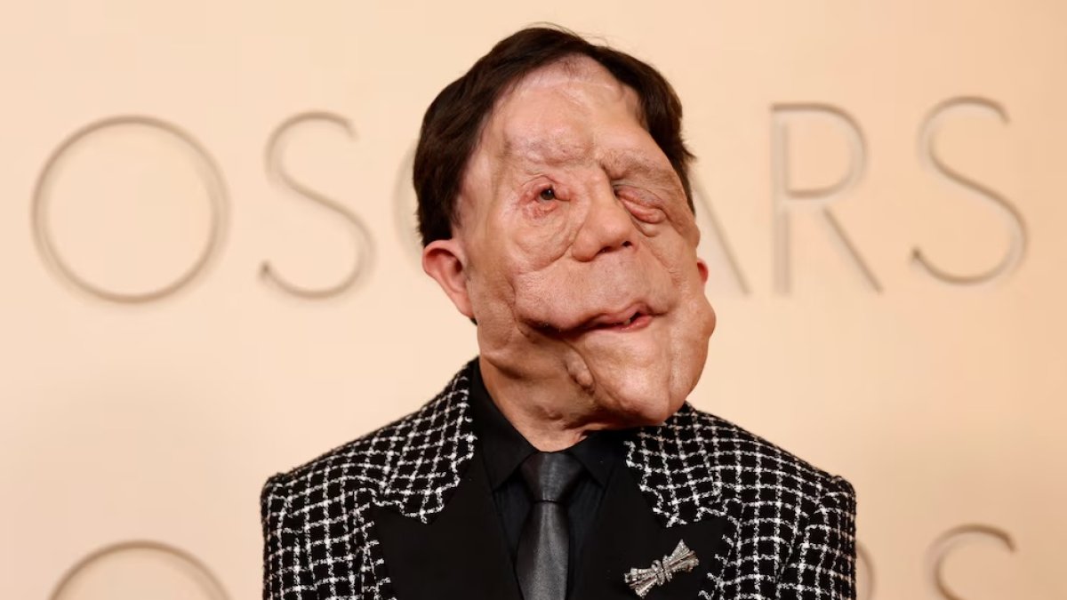 El actor británico Adam Pearson