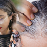 Canas en la juventud