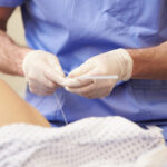 Ginecólogo durante un tratamiento de fertilidad