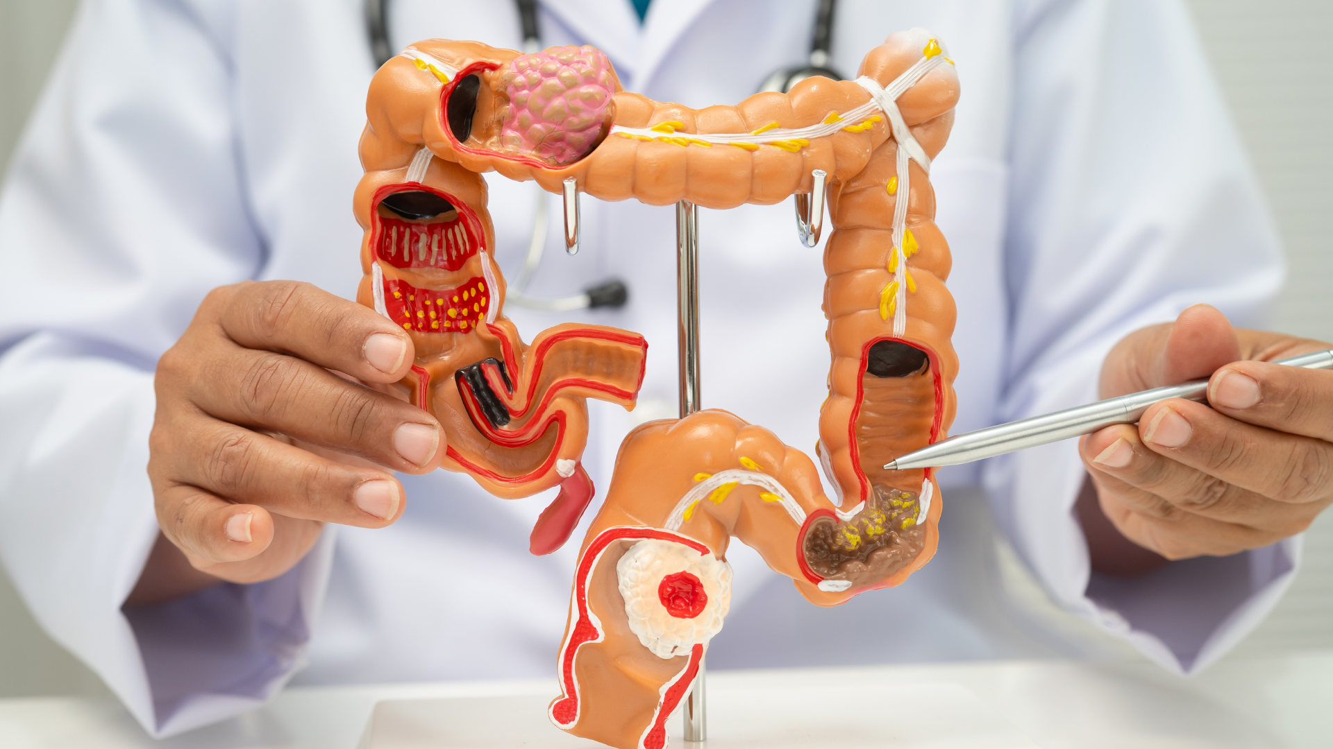 Según los investigadores, este herbicida deja una especie de “huella” en el ADN que podría influir en la aparición de tumores a edades más tempranas.