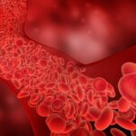 El colesterol amenaza la salud cardiovascular, según experto