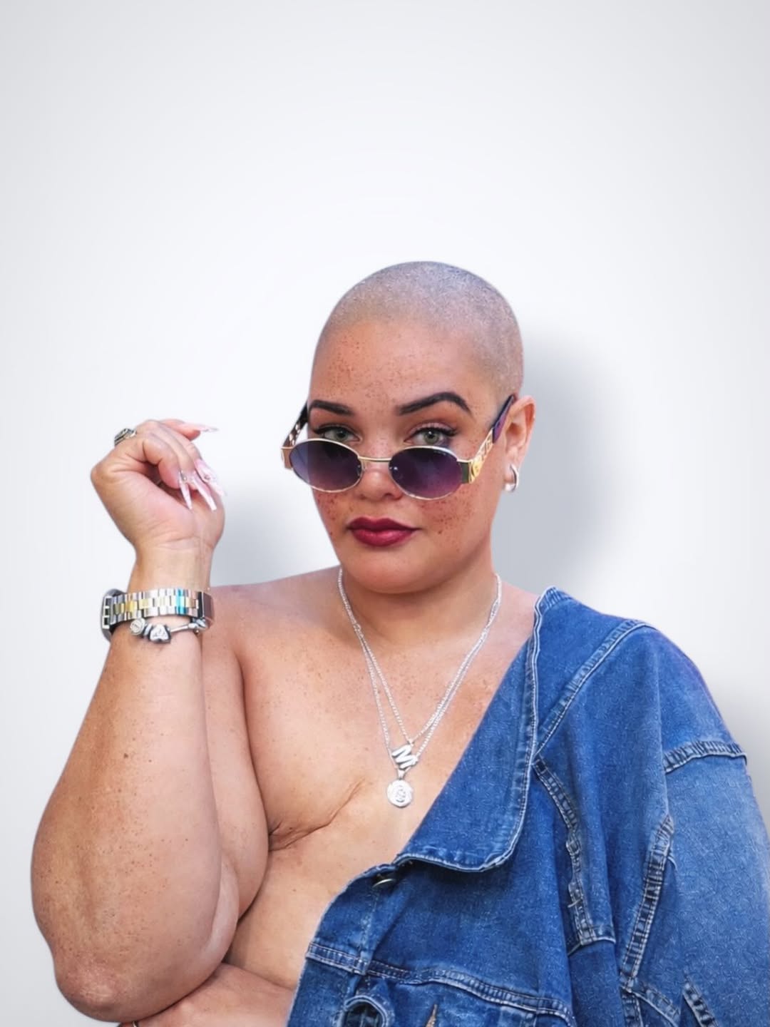 "Mi lucha continúa": Olga Mercedes solicita apoyo solidario para costear su tratamiento contra el cáncer