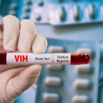 Conavihsida: 20 mil personas con VIH abandonaron tratamiento