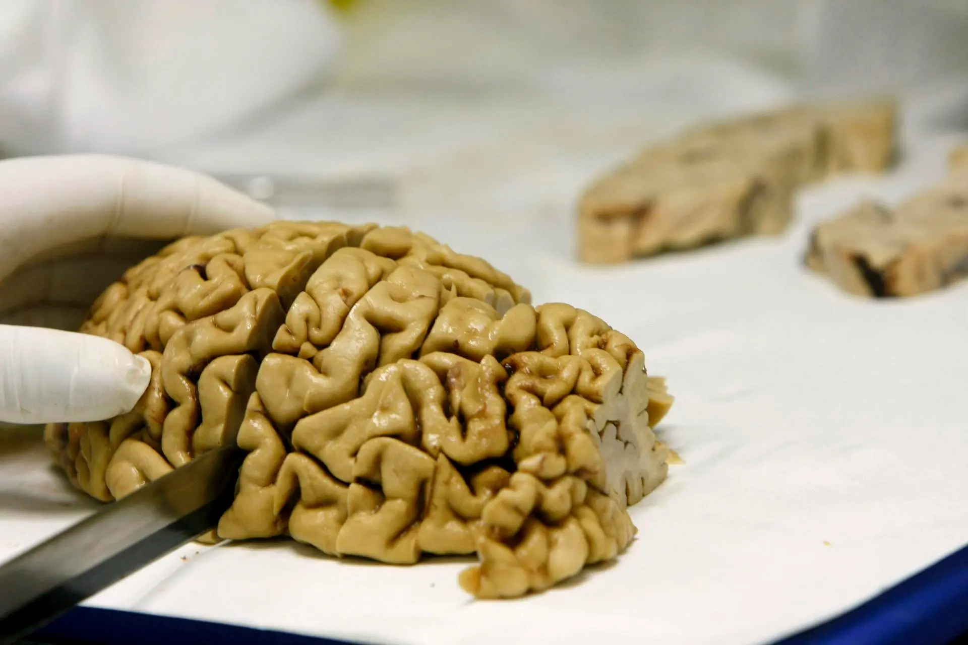 El cerebro humano es la fuente de energía que se regenera con el sueño y el descanso. /EFE.